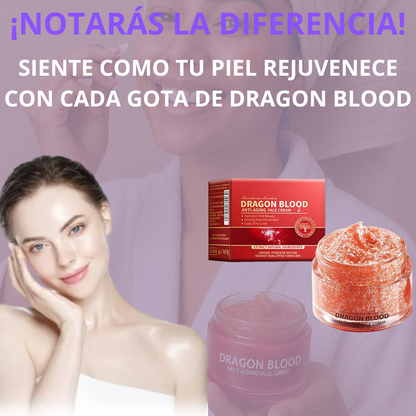 ¡10 Años Menos! Crema Rejuvenecedora de Sangre de Dragon