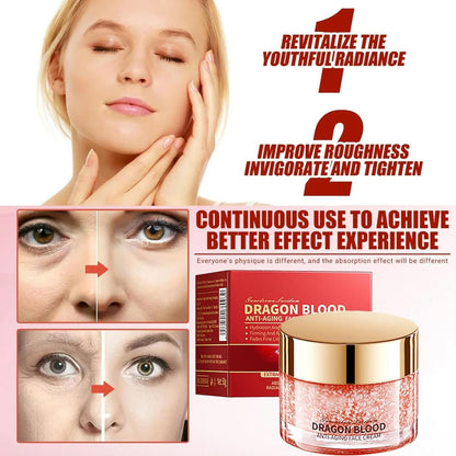 ¡10 Años Menos! Crema Rejuvenecedora de Sangre de Dragon